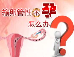 输卵管性不孕